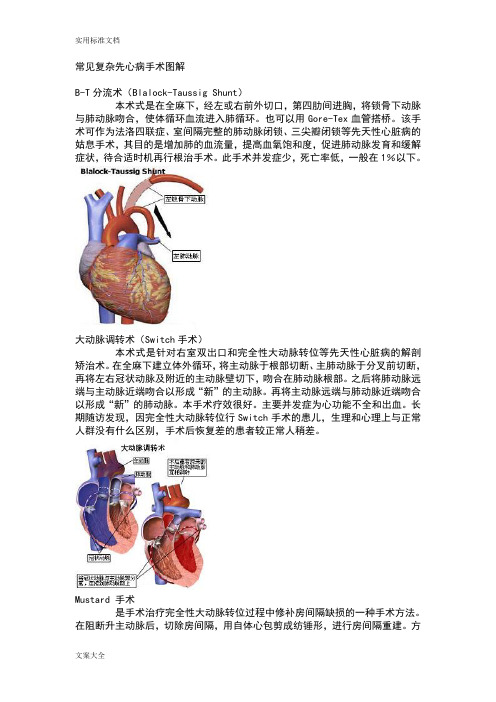 常见复杂先心病手术现用图解