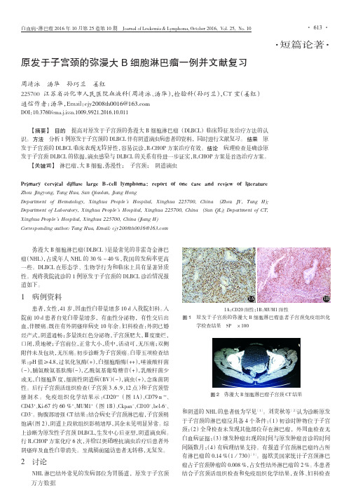 原发于子宫颈的弥漫大B细胞淋巴瘤一例并文献复习重点