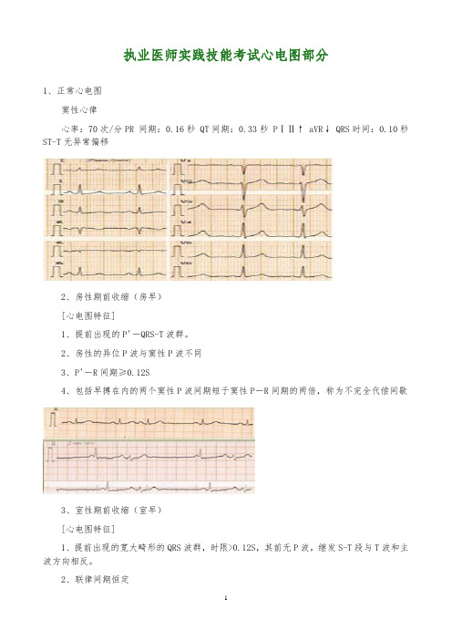 执业医师实践技能考试心电图部分