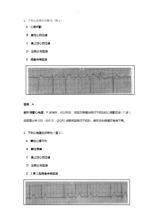 心电图精华50题