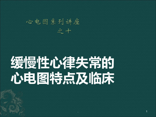 (医学课件)缓慢性心律失常ppt演示课件