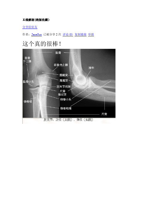 四肢X片图谱