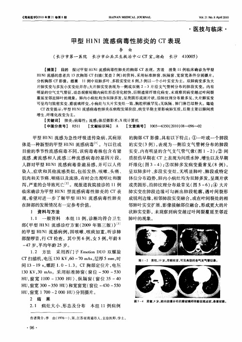 甲型H1N1流感病毒性肺炎的CT表现