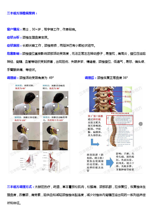 颈椎病案例13