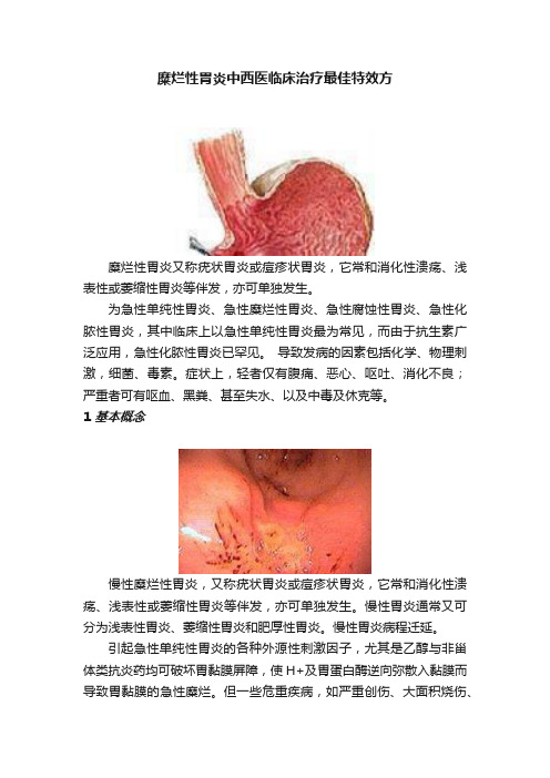 糜烂性胃炎中西医临床治疗最佳特效方