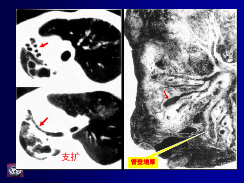 呼吸系统影像诊断