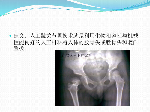 人工髋关节置换的术后护理PPT课件