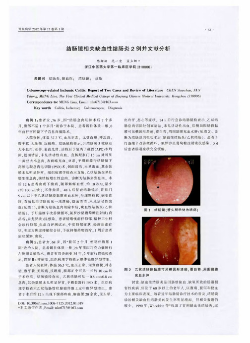 结肠镜相关缺血性结肠炎2例并文献分析