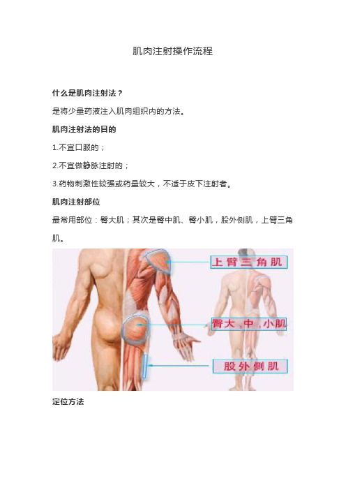 肌肉注射操作流程