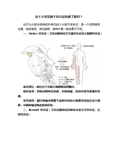 这十大常见脑干综合征你都了解吗？