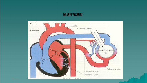 肺动脉高压课件分享