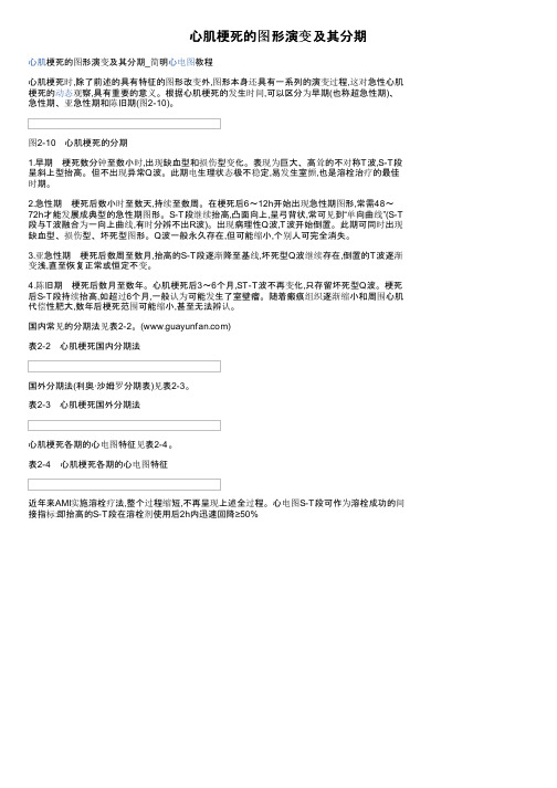 心肌梗死的图形演变及其分期