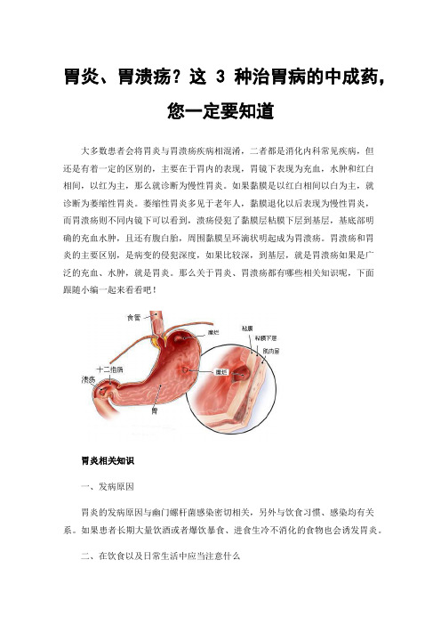 胃炎、胃溃疡？这3种治胃病的中成药，您一定要知道