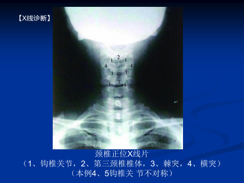 脊柱的影像学诊断