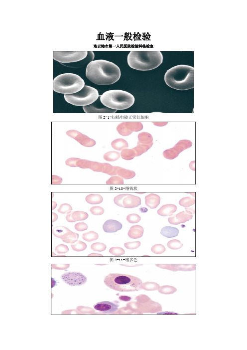 血液一般检验图谱
