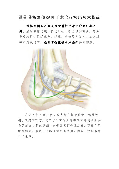 跟骨骨折复位微创手术治疗技巧技术指南