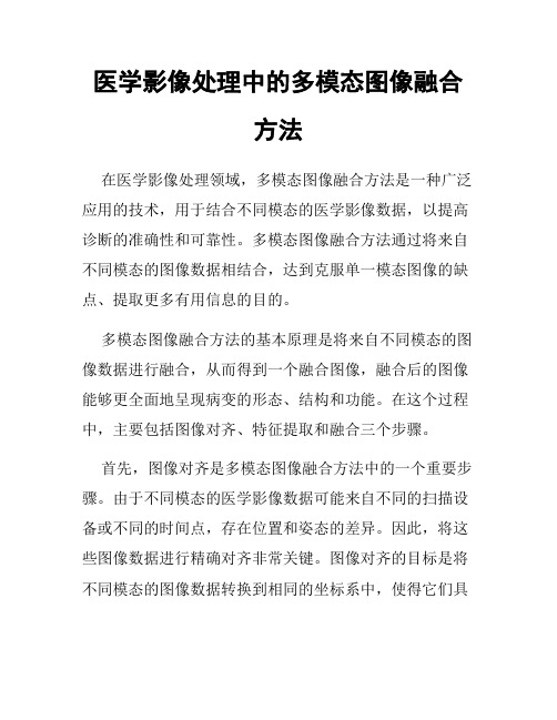 医学影像处理中的多模态图像融合方法