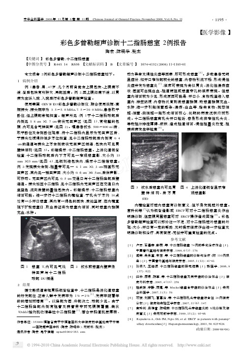 彩色多普勒超声诊断十二指肠憩室2例报告