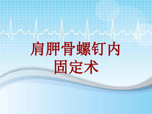 外科手术教学资料：肩胛骨螺钉内固定术讲解模板