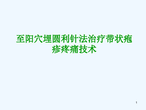 至阳穴埋元利针法治疗带状疱疹疼痛技术