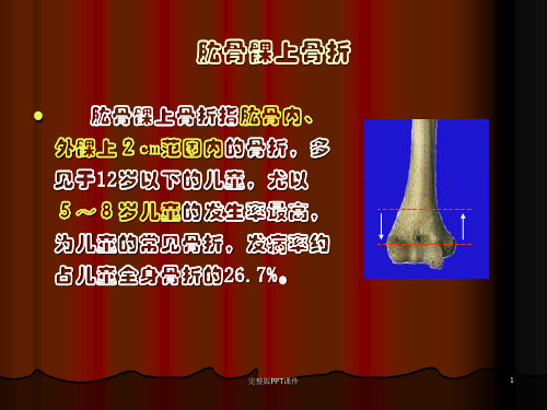 肱骨髁上骨折ppt课件