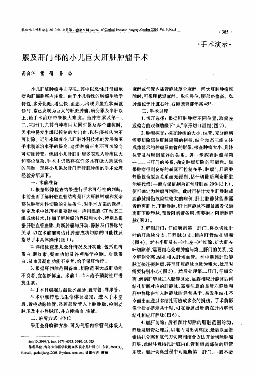 累及肝门部的小儿巨大肝脏肿瘤手术