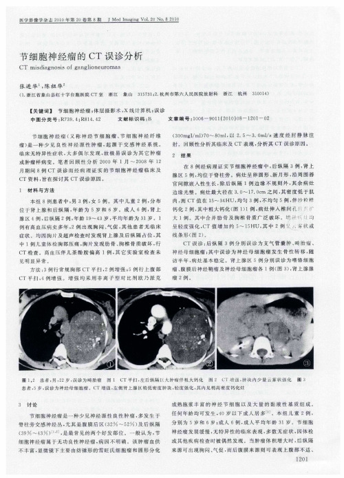 节细胞神经瘤的CT误诊分析