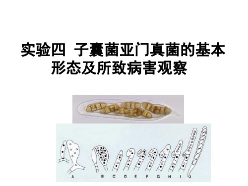 实验四 子囊菌亚门真菌的基本形态及所致病害观察PPT课件