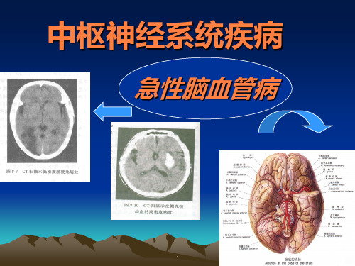 急性脑血管病(简) ()ppt课件