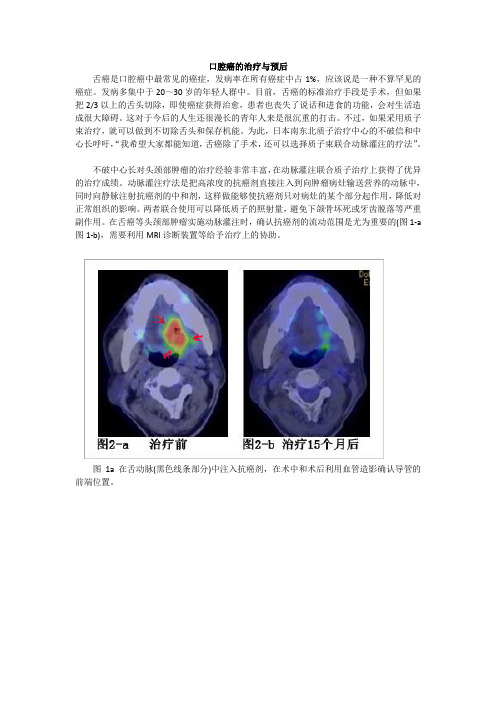 口腔癌的治疗与预防