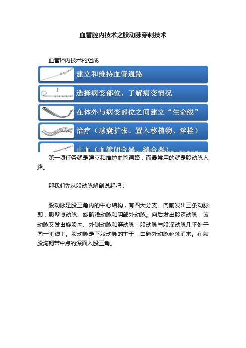 血管腔内技术之股动脉穿刺技术