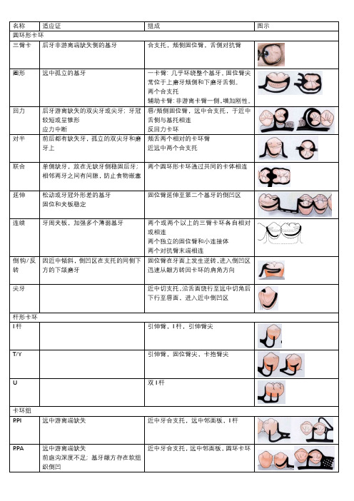 可摘局部义齿卡环种类