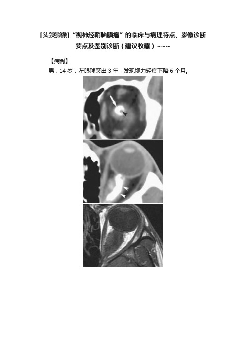 [头颈影像]“视神经鞘脑膜瘤”的临床与病理特点、影像诊断要点及鉴别诊断（建议收藏）~~~