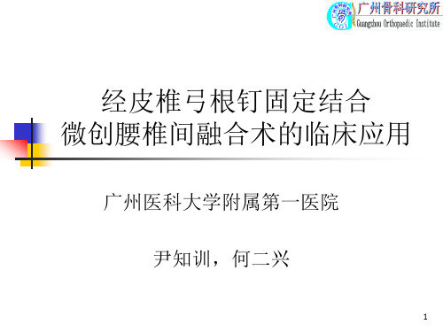 经皮椎弓根钉固定结合腰椎间融合术的临床应用PPT参考幻灯片