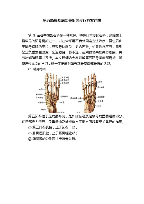 第五跖骨基底部骨折的诊疗方案详解