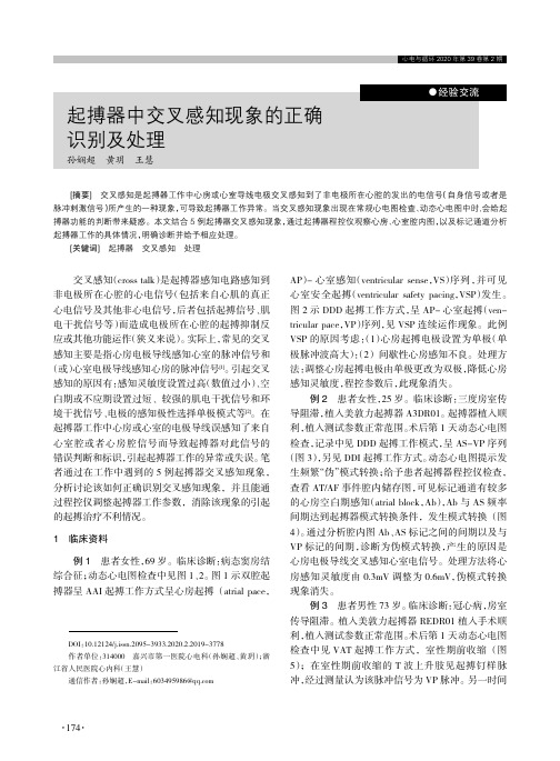 起搏器中交叉感知现象的正确识别及处理