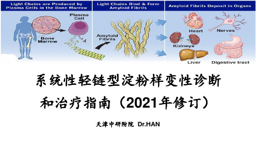 系统性轻链型淀粉样变性诊断和治疗指南(2021年修订)