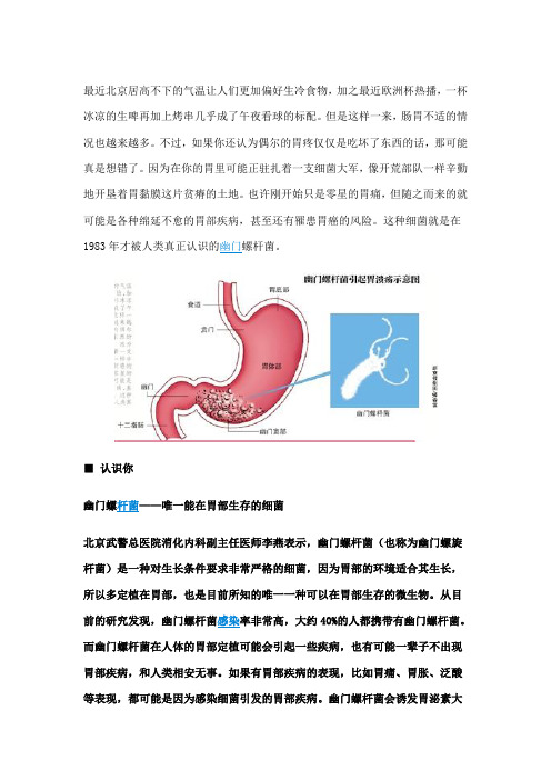 幽门螺杆菌唯一能在胃部生存的细菌