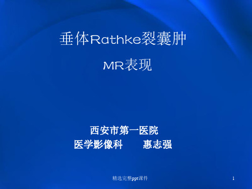 垂体Rathke裂囊肿