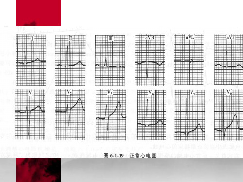心电图课件2