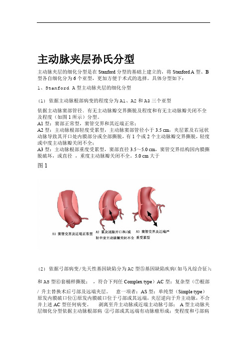 夹层分型及治疗方式