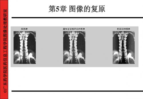 第5章医学图像的复原