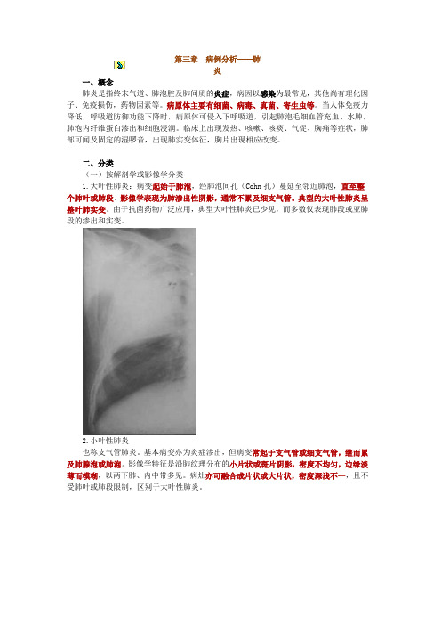 病例分析——肺炎.doc