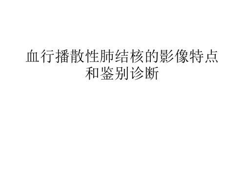 血行播散性肺结核的影像特点和鉴别诊断