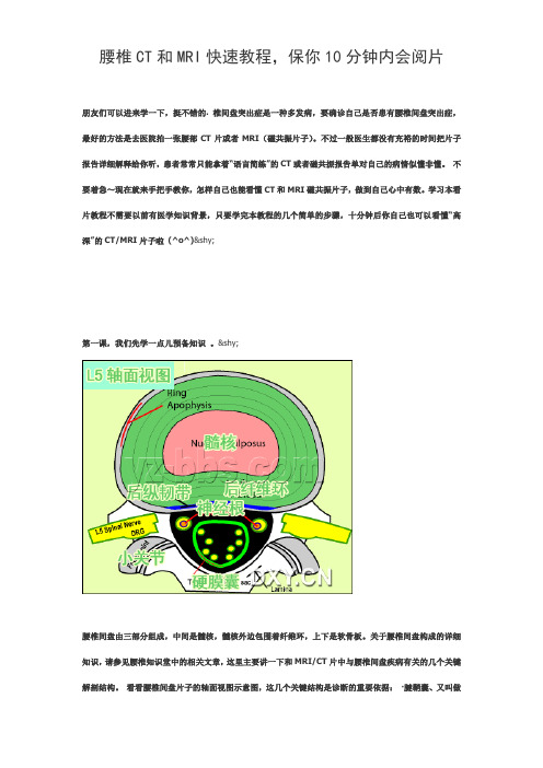 腰椎CT和MRI快速教程,保你10分钟内会阅片