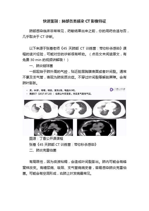 快速鉴别：肺部各类感染CT影像特征