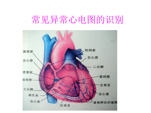 正常心电图及常见异常心电图的识别及处理PPT课件