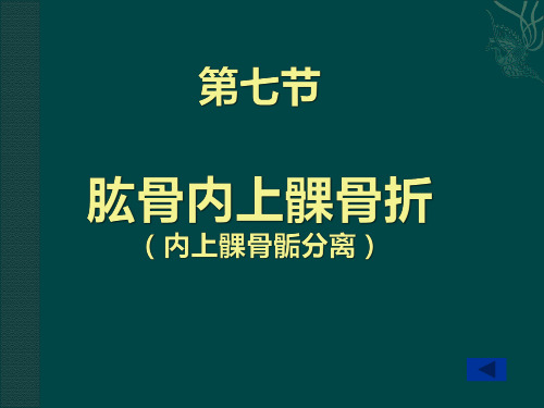 肱骨内上髁骨折【38页】