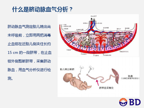 脐动脉血血气分析的临床应用