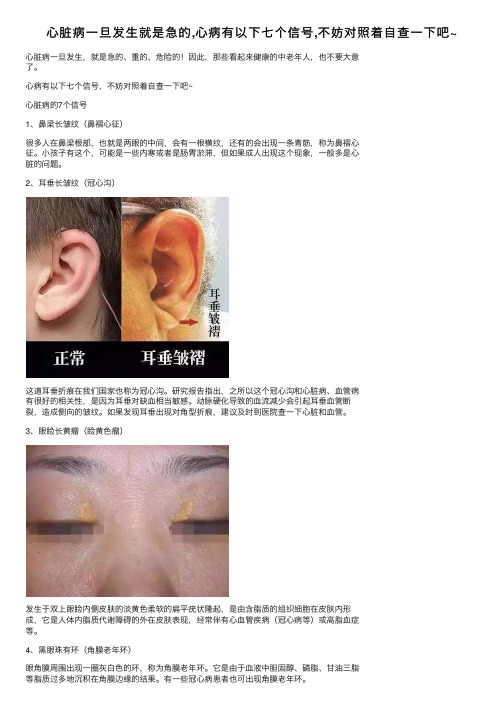 心脏病一旦发生就是急的,心病有以下七个信号,不妨对照着自查一下吧~